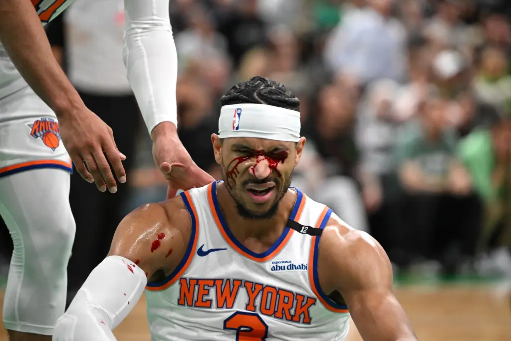 Josh Hart de los Knicks sangra tras recibir un codazo en un momento aterrador