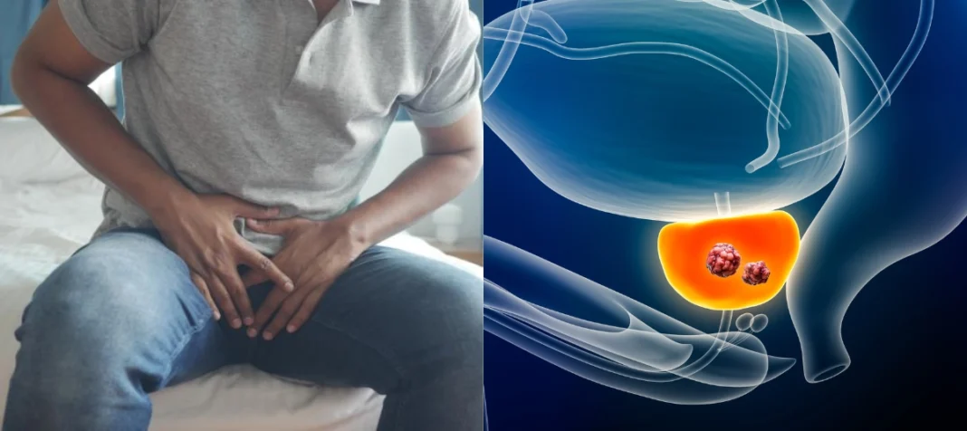 Así funciona la prueba casera para detectar cáncer de próstata en solo 15 minutos: tiene un 83 % de precisión Así funciona la prueba casera para detectar cáncer de próstata en solo 15 minutos: tiene un 83 % de precisión