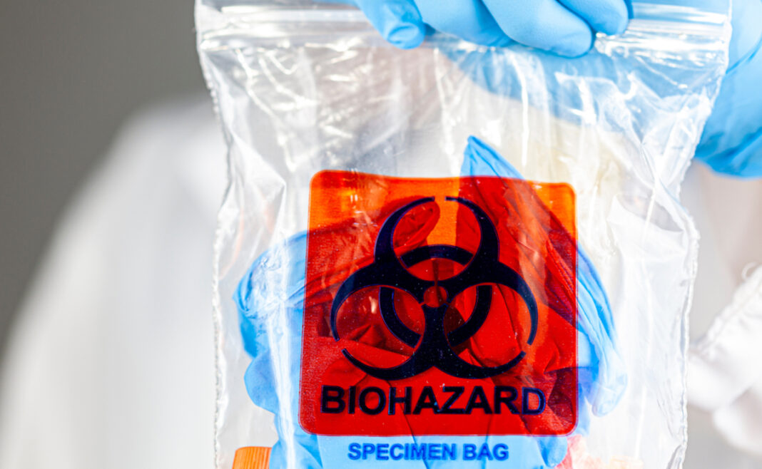 Otro científico chino, de Wuhan, acusado de contrabandear material biológico ilegal a Estados Unidos Otro científico chino, de Wuhan, acusado de contrabandear material biológico ilegal a Estados Unidos