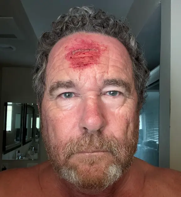 Fotógrafo del Post recibió un disparo en la cabeza con una bala de goma durante disturbios contra ICE en Los Ángeles, y capturó el aterrador momento en cámara. Fotógrafo del Post recibió un disparo en la cabeza con una bala de goma durante disturbios contra ICE en Los Ángeles, y capturó el aterrador momento en cámara.