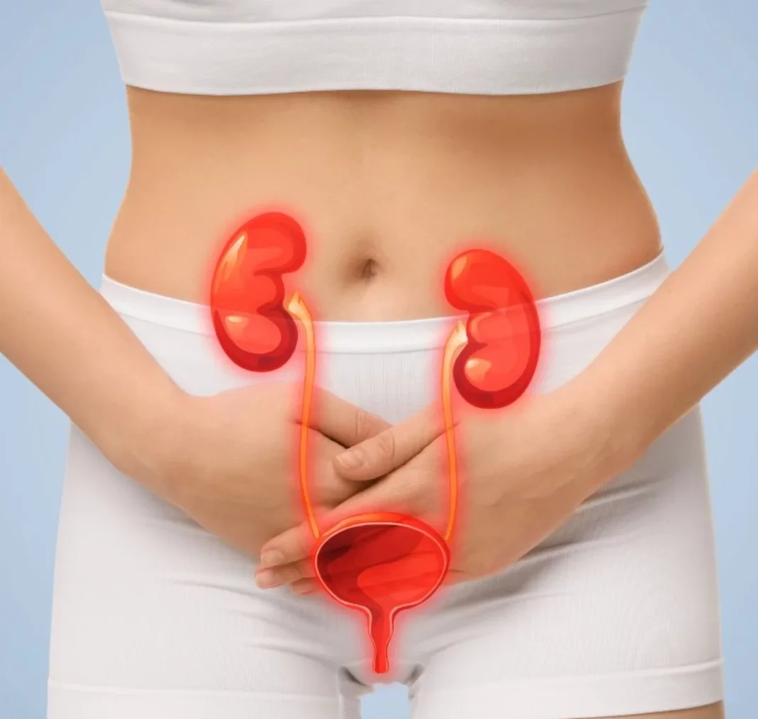 El 90 % de los casos de cistitis intersticial se presentan en mujeres