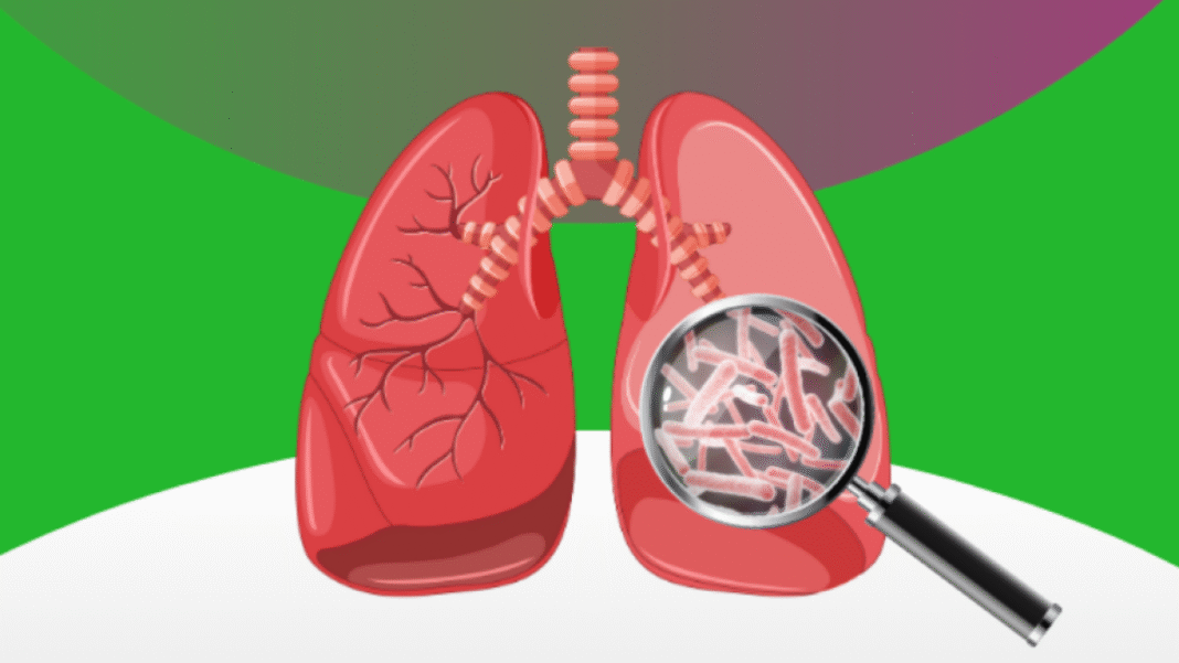 Día Mundial de Concientización sobre las Micobacterias No Tuberculosas: qué son y cómo afecta Día Mundial de Concientización sobre las Micobacterias No Tuberculosas: qué son y cómo afecta