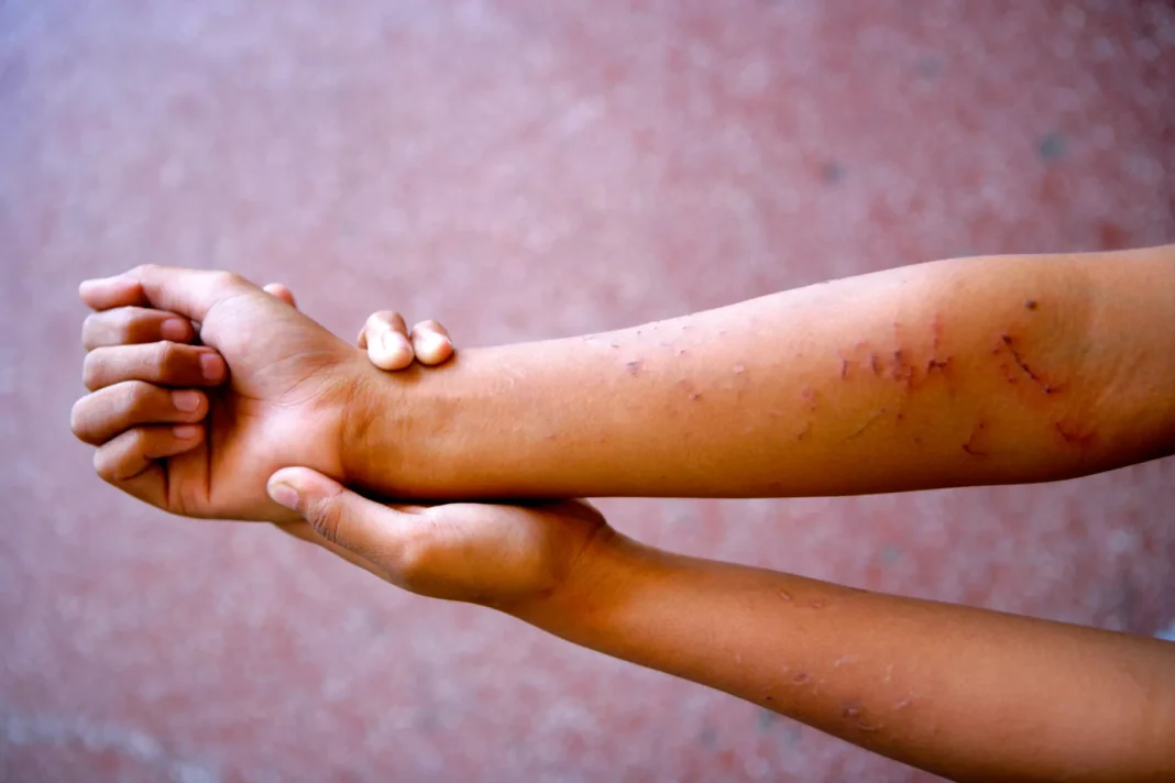 El 76 % de las niñas dominicanas sufren violencia