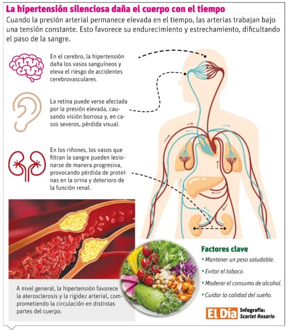 Hipertensión arterial: conocer tus números puede salvarte la vida Hipertensión arterial: conocer tus números puede salvarte la vida