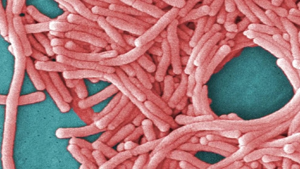 Brote del legionario ya suma 23 casos y 17 hospitalizados en Nueva York Brote del legionario ya suma 23 casos y 17 hospitalizados en Nueva York